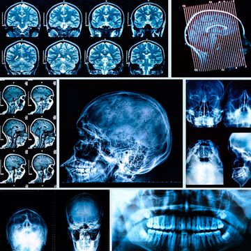 Centro Dental Txorierri radiografía 1